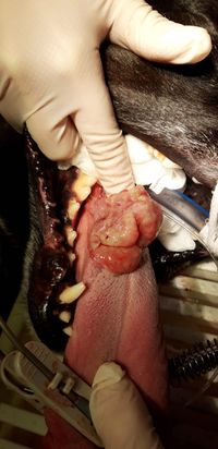 Tumor auf der Zunge